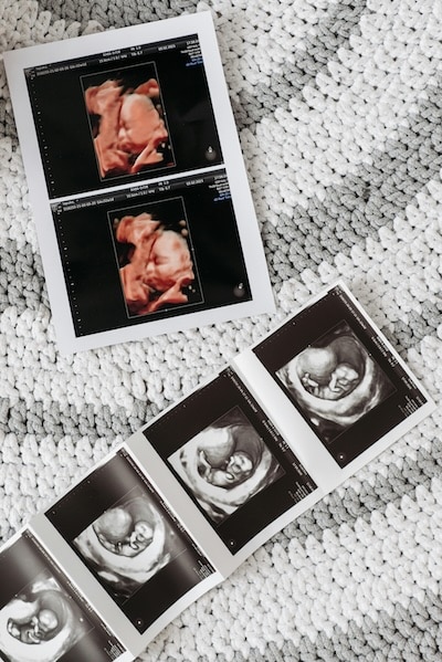 Surrogacy near you